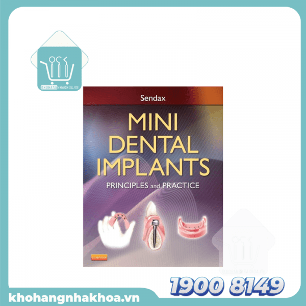 Mini Dental Implants: Principles and Practice - Phát Triển Vượt Bậc trong Cấy Ghép Nha Khoa