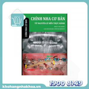 chỉnh nha cơ bản